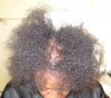 Hair-thinningfront-Jan2011.jpg
