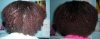 Back showing 1st and 2nd week on doing cassia henna treatment on 23 and 28 February 2013.jpg